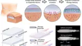Medizintechnik Implantate Diabetes Therapie 