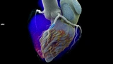 Medizintechnik Radiologie Siemens Healthineers CT Photon Counting Halbleiter Züchtung Computertomografie
