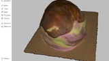 Medizintechnik Brustvolumen 3D-Scan BH Orthopädie