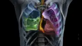 Siemens Healthineers Digitaler Zwilling Vision Medizintechnik