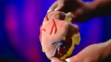 Medizintechnik 3D-Druck Stratasys Kunststofffertigung Implantate Prothesen