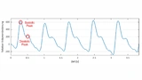 Ein PPG-Signal (aufgenommen mit dem System aus Bild 1) enthält auch einen diastolischen Peak, der weniger ausgeprägt ist und sich deshalb nur schwierig mit analoger Schaltungstechnik erfassen lässt