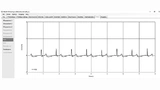 Die EKG-Aufzeichnung mit dem MAX86178 Evaluation Board liefert gute und reproduzierbare Messwerte