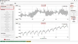Die Signale der EKG- und der PPG-Messung weisen eine unzureichende Qualität auf, und es ist noch nicht einmal der QRS-Komplex eindeutig zu identifizieren