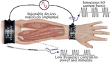 Medizinelektronik IBMT Neurostimulation Implantate Sensorik Muskelzittern Tremor