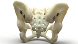 Medizintechnik Implantat Knochenbrüche FDA