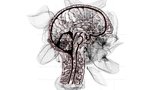 medizintechnik Neuromodulation alzheimer CRISPR Wachstum