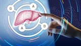 Medizinelektronik E-Health Digital Health Roche Diagnostics Labor Biomarker KI Krebs Diagnose Prävention