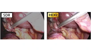 Medizinische Displays Medizintechnik OP Endoskopie Chirurgie Imaging Vision