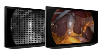 Medizintechnik Sony healthcare op Chirurgie Endoskopie display vision Bildgebung