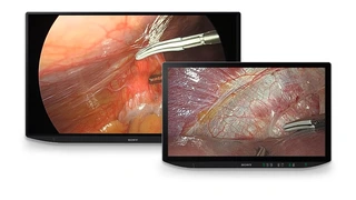 Medizintechnik Sony healthcare op Chirurgie Endoskopie display vision Bildgebung