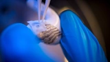 Medizintechnik Sensorik Gedruckte Elektronik Kopfhörer Ohrhöhrer Gehirn Messen Vitaldaten Parkinson Neurolink