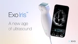  Exo Imaging launched its new Exo Iris" ultrasound system last fall. It is based on a sensor array that integrates 4096 PMUTs.