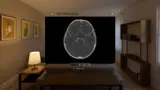 Siemens Healthineers Apple Vision Pro Chirurgie OP Planung AR VR Augmented Reality Vision
