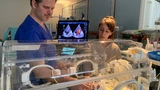 Medizintechnik ETH Zürich KI Künstliche Intelligenz Herzfehler Neugeborene Regensburg Pulmonale Hypertonie