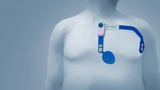Analog Devices sensinel kardiopulmonal diagnose überwachung
