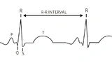 Mouser Wearable Entwicklung Medizintechnik Vitaldaten IC-Design Power Management Developement Medtech Medical Vital sign