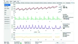Mouser Wearable Entwicklung Medizintechnik Vitaldaten IC-Design Power Management Developement Medtech Medical Vital sign