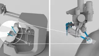 Roboter Sony Medizintechnik Chirurgie Robotik Medizinrobotik Operation Telemedizin Remote-OP Nähen
