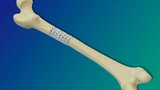 IFAM Fraunhofer Kunststoff Glas Polymer Knochen Gerüst Bruch Heilung