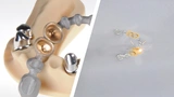 Zahnersatz 3D-Druck günstig Fidentis Medizintechnik Förderung