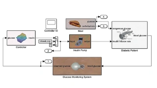 In-silico-Medizinmodell eines künstlichen Pankreassystems in Simulink