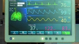 Hyline Medizintechnik Displays Panel-PC Medical Digitalisierung