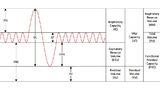 Würth Elektronik Eisos Medizintechnik Spirometer Entwicklung Lungenvolumen Home Care Lunge
