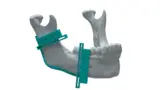 Medizintechnik Siemens Digital Industries Software Additive Fertigung Workflow Prozessmanagement