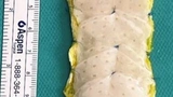 Medizintechnik Pflaster Herzschwäche Operation Herzmuskelgewebe Uniklinik Göttingen