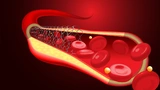 Medizintechnik Fertigung Reinigung Ultraschall Teilereinigung Sauberkeit Oberflächen Hygiene Produktion