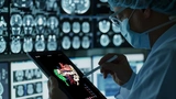 Storz Karl Innersight Chirurgie 3D CT MRT Bilder OP-Planung