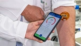 Menschen mit chronischer Nierenerkrankung können ihren Kaliumspiegel künftig eigenständig zu Hause messen und sich die Ergebnisse am Smartphone anzeigen lassen.