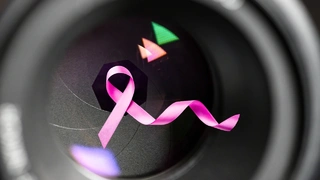 Die Aufnahmetechnik des »Flying Focal Spot« sorgt in der Brustkrebsvorsorge via Mammografie für deutlich schärferer und besser zu diagnostizierende Bilder - ohne die unangenehme Untersuchung zu verlängern.